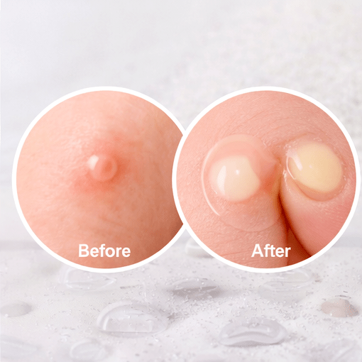 COSRX Acne Pimple Master Patch | Acne Spot Treatment | AmiGlow NZ - AmiGlow
